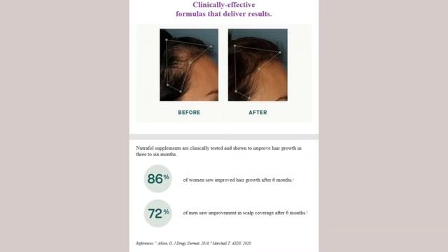 Hair Loss? Nutrafol vitamins & serum available! смотреть онлайн