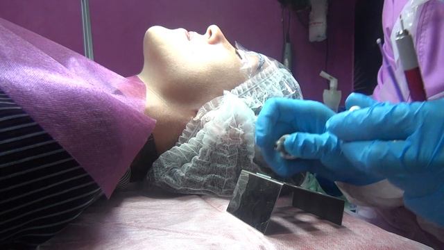 Анестезия брови перед микроблейдингом Начало процедуры