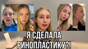 Я СДЕЛАЛА РИНОПЛАСТИКУ?ОПЕРАЦИЯ НА НОС?