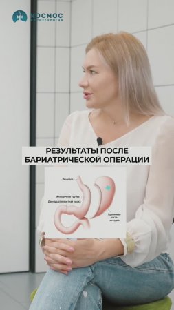 Результаты Ильи после бариатрической операции #похудение