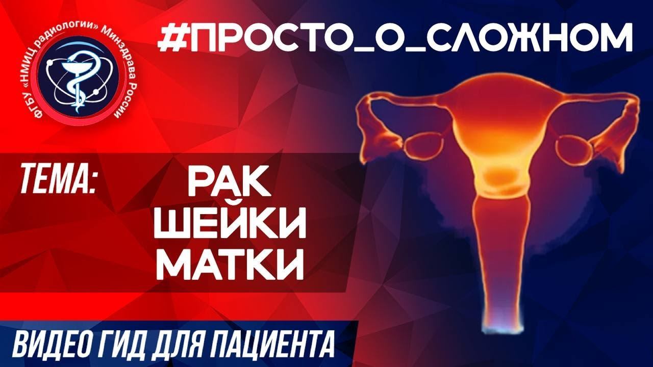 #ПРОСТО_О_СЛОЖНОМ Рак шейки матки