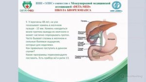 Камни в желчном пузыре 2022.01.19