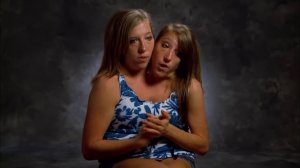 How Do Conjoined Twins Teach A Class? | Abby and Brittany