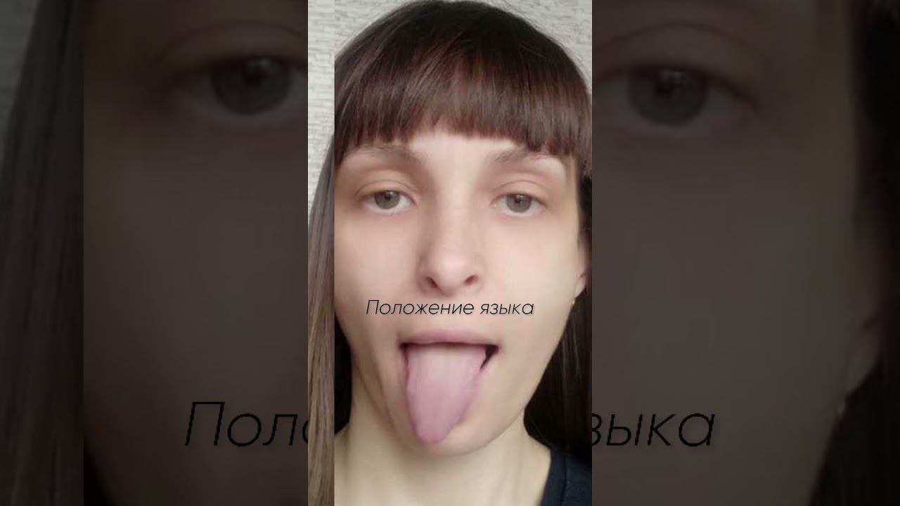 КАК УСТРАНИТЬ АСИММЕТРИЮ ЛИЦА И ТЕЛА?