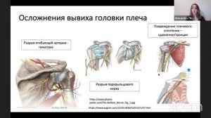 ЛЕКТОРЫЙ. РУПАР БДМУ. Транспортная иммобилизация. Александра Титова