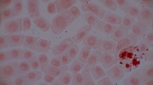 Митоз в клетках корешка лука