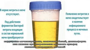 Нитриты в анализе мочи