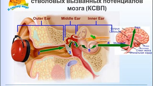 Кохлеарная имплантация  как происходит отбор пациентов