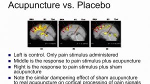 The Science behind Analgesia with Veterinary Acupuncture presented by Dr Steve Marsden