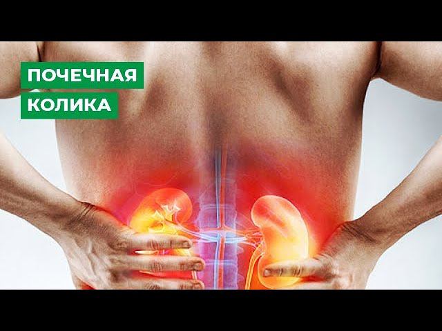 Почечная колика