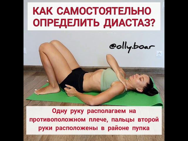 ДИАСТАЗ ПРЯМЫХ МЫШЦ ЖИВОТА. САМОДИАГНОСТИКА