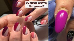 РАЗЛОМ НОГТЯ аппаратный маникюр