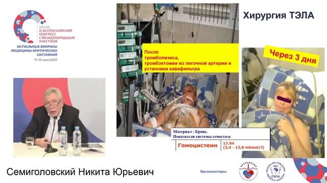 ТЭЛА Семиголовский Н.Ю. смотреть онлайн