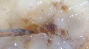 Опасная личинка внутри банана под микроскопом