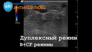 УЗИ вен нижних конечностей: 1. Режимы УЗИ