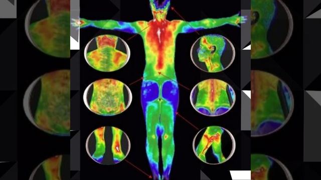 La cámara infrarroja funcional AO es un dispositivo clínico de imágenes térmicas смотреть онлайн