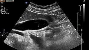 УЗИ анатомия органов брюшной полости.