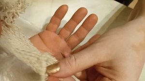 Лечение кашля методом Су-Джок, компресс на область легких по стандартной системе соответствия.