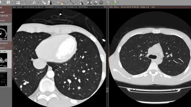 Запис 2019 05 01 07 07 58 183 смотреть онлайн