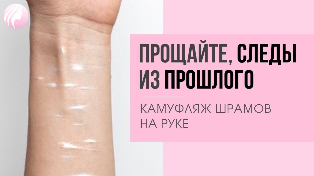 ШРАМЫ НА РУКАХ. Перекрытие шрамов на руке