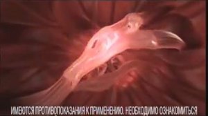 Реклама Нурофен: Нурофен гель