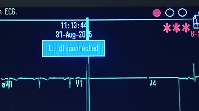 MAC 5500 Training Video (Part 1) смотреть онлайн