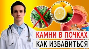 Самый частый вид камней почек: как избавиться  ОКСАЛАТЫ в моче  2022