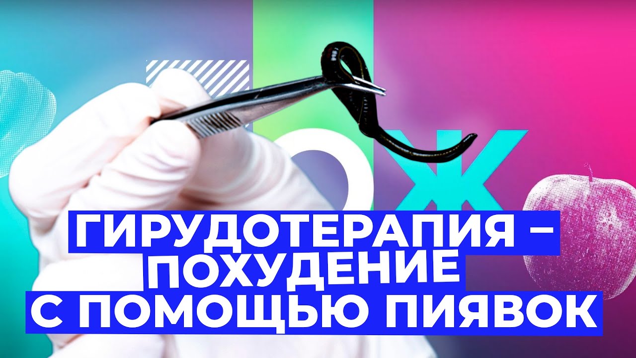 Гирудотерапия: помогают ли ПИЯВКИ для похудения? // Злобный ЗОЖ