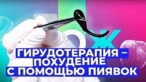 Гирудотерапия: помогают ли ПИЯВКИ для похудения? // Злобный ЗОЖ