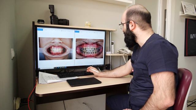 Рублика "Вопрос-ответ" отвечает на вопрос врач-ортодонт Урганаев Саид Гаджиаттаевич смотреть онлайн