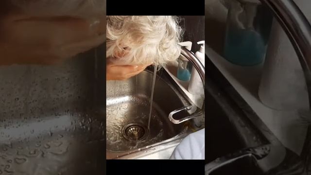 Первая помощь при ожогах. Смываем химический пилинг.#shorts смотреть онлайн