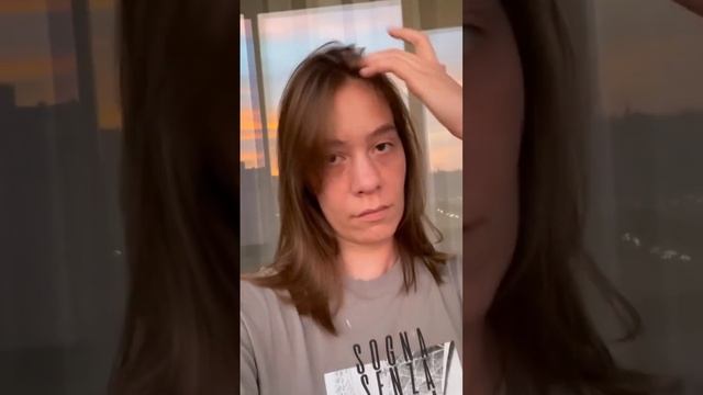 БЕЗ БРЕКЕТОВ 1 год: как меняется внешность. Аппарат Планас