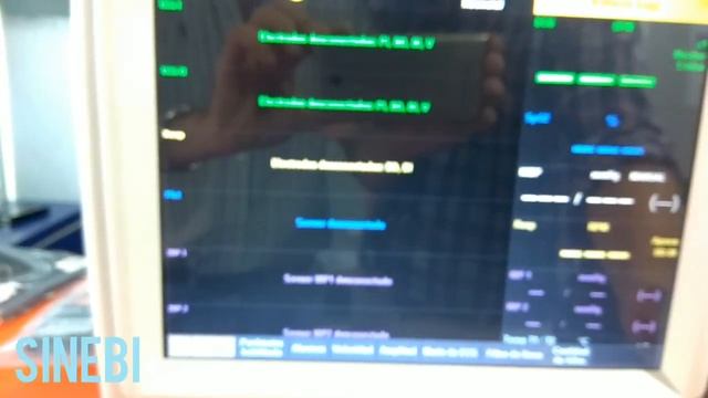 Monitor Multiparametrico Cardiotecnica MA512 SINEBI смотреть онлайн