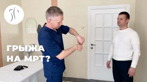 Сорвал спину. На мрт грыжа L5-S1. | Костоправ Саксин Алексей