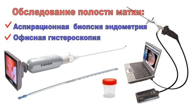 Промо "ЭНДОМЕТРИОЗ - АДЕНОМИОЗ" смотреть онлайн