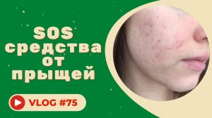 SOS средства от прыщей из аптеки и косметологии