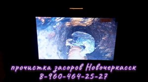 Извлекаем посторонний предмет из тела.
