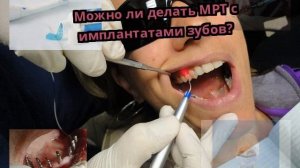 Можно ли делать МРТ с имплантатами зубов?