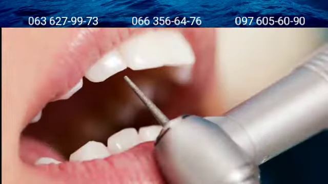 Где в Николаеве полечить зубы. Стоматологическая клиника Семейная Стоматология. Лечение. Украина смотреть онлайн