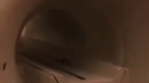 ПОЧЕМУ НЕЛЬЗЯ ДЕЛАТЬ МРТ с металлами?