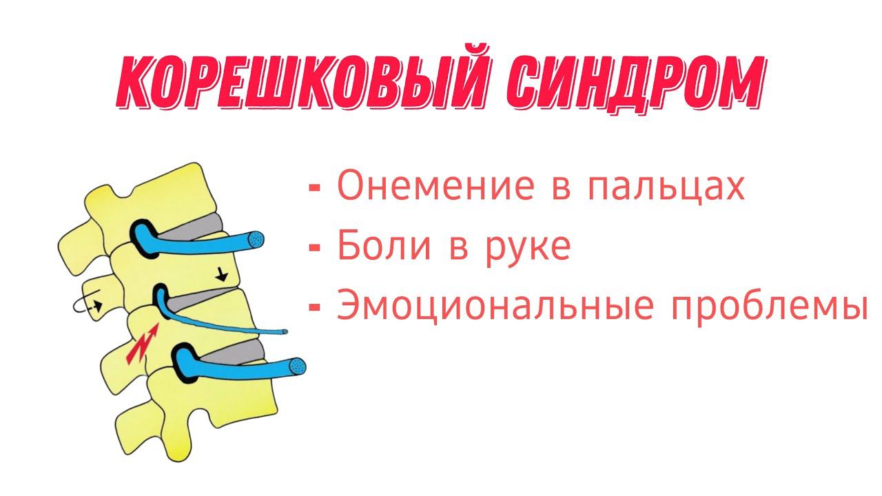 Приём кинезиолога. Онемение рук. Боли. Эмоции. Тут используются различные техники.