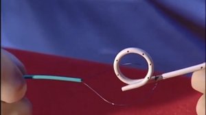 Удалитель стентов мочеточниковых