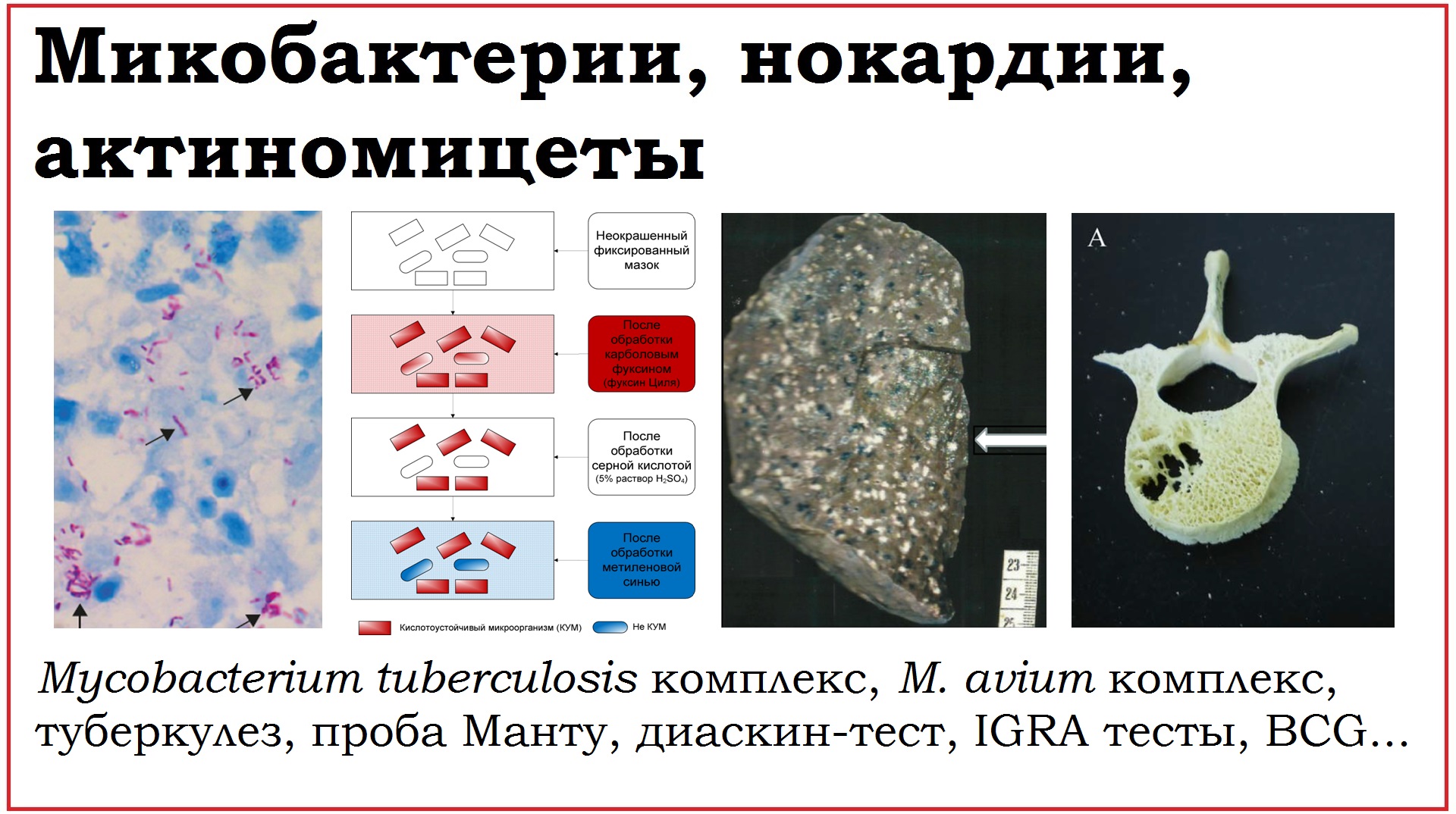 24. Клинически значимые бактерии родов Mycobacterium, Nocardia, Actinomyces