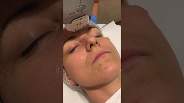 Zabieg HIFU na naszym urządzeniu Ultraformer III смотреть онлайн