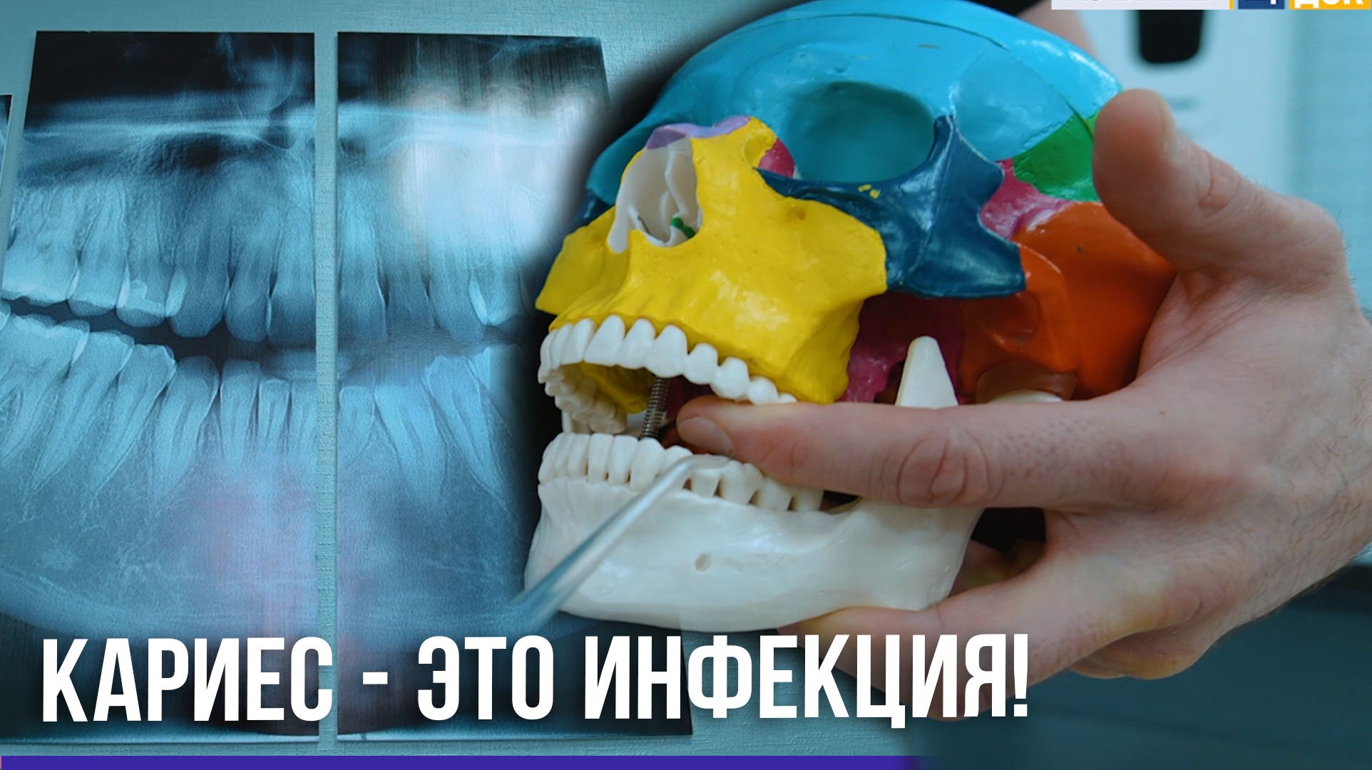 99% НАСЕЛЕНИЯ ЗЕМЛИ СТРАДАЮТ ОТ КАРИЕСА
