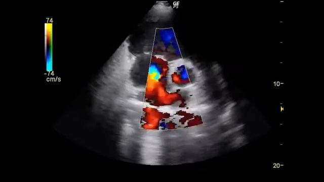 ВПС 2 смотреть онлайн