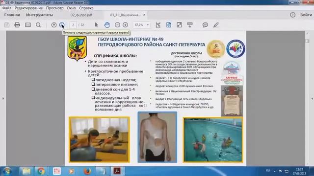 Вебинар "Мой выбор - здоровый образ жизни" смотреть онлайн