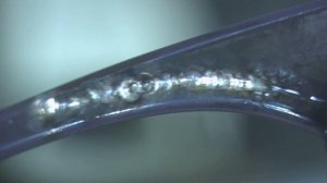 ПАЙКА ЛАЗЕРОМ ОТСЛОИВШЕЙСЯ ОПРАВЫ