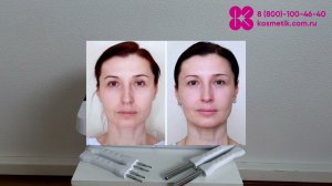 Обзор аппарата B-9922