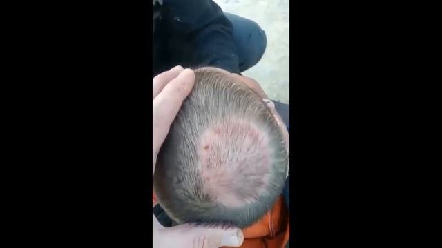 Теміреткі  Лейшманиоз емдеу 87774237989 емдік шөп, бал, майлардан тұрады құрамы